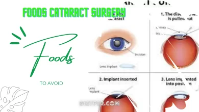 food not to eat after cataract surgery