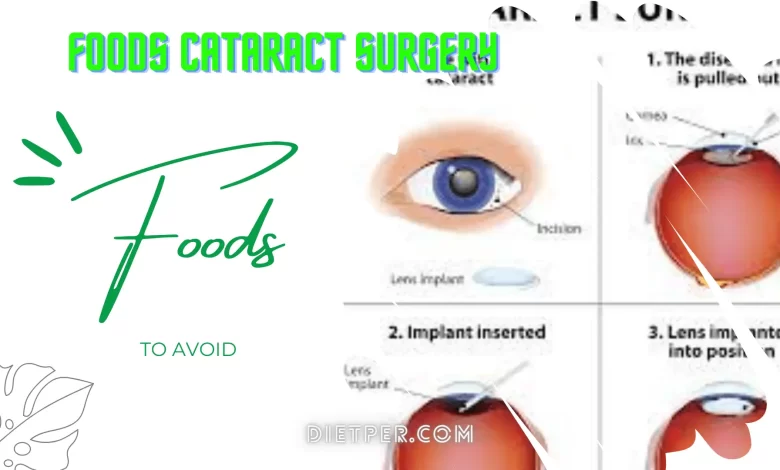 food not to eat after cataract surgery